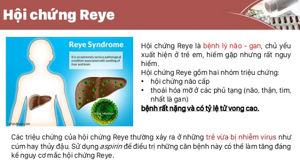 Hội chứng Reye