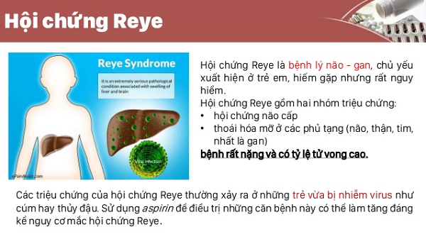 Hội chứng Reye là bệnh lý nguy hiểm có thể dẫn đến tử vong cao